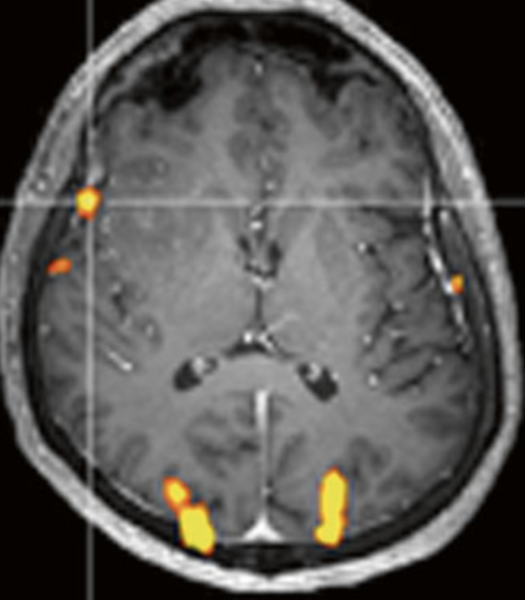 Fil:FMRI sprog.png