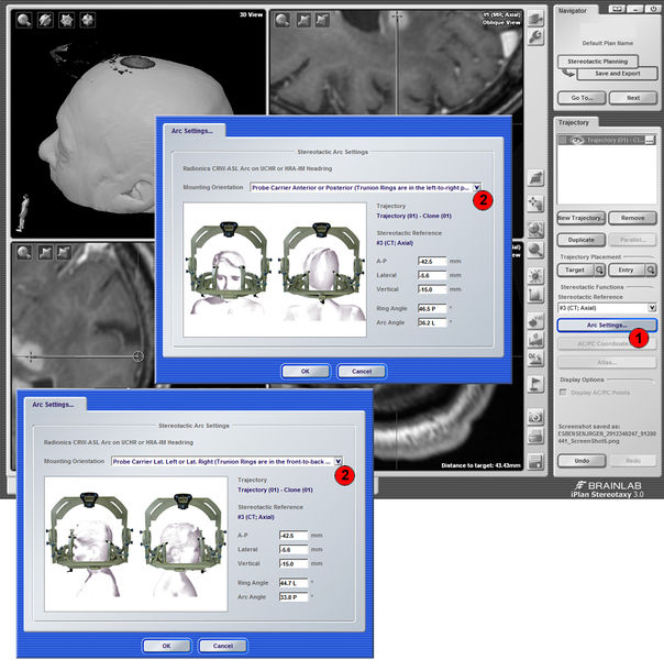 Fil:SB-BrainLab7x.jpg
