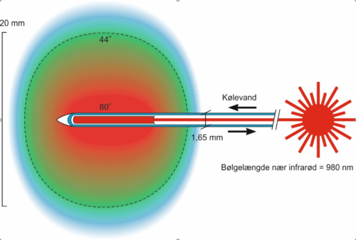 Laserfiber.png