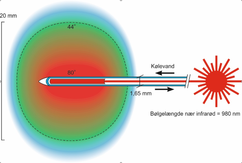 Fil:Laserfiber.png