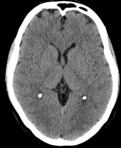 ct scanning af hjertet ventetid