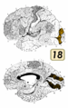 Brodmann Cytoarchitectonics 18.png