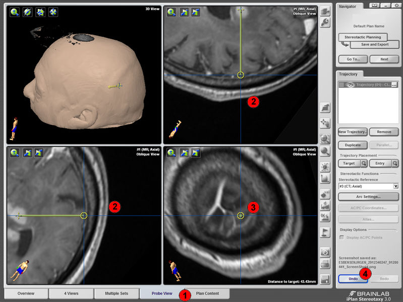 Fil:SB-BrainLab6x.jpg