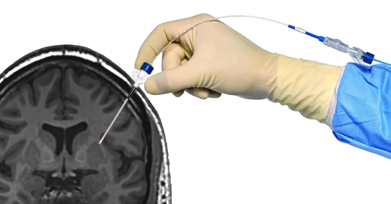 Fil:Hånd med skrue.png