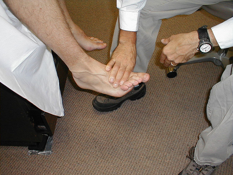 Fil:Neuro exam dorsi flexion.jpg
