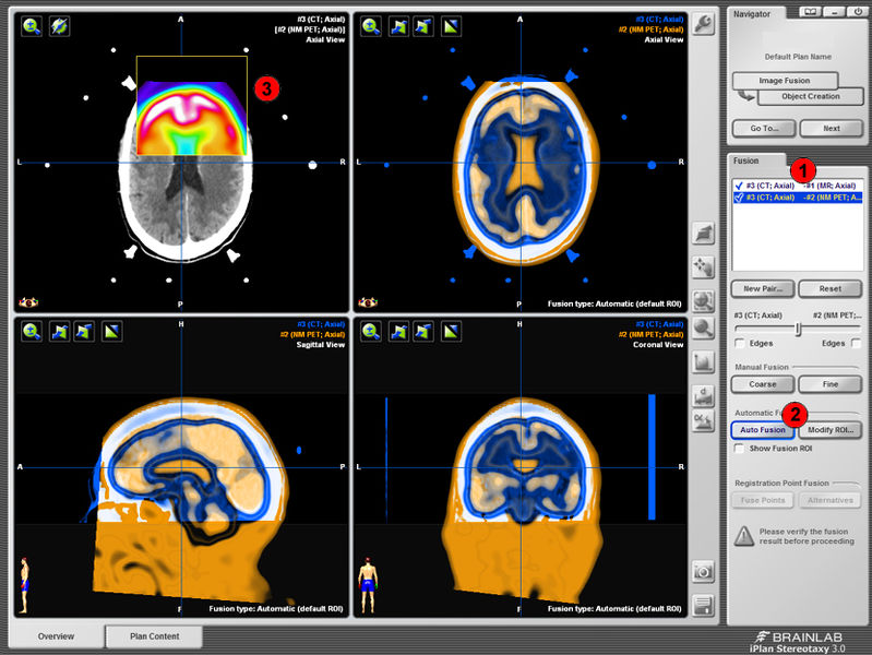 Fil:SB-BrainLab4x.jpg