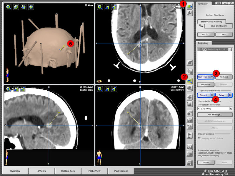 Fil:SB-BrainLab5x.jpg