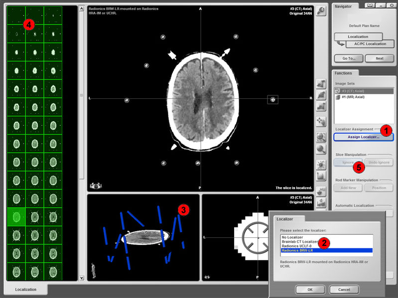 Fil:SB-BrainLab2x.jpg