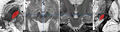 Miniature af versionen fra 11. apr. 2013, 13:11