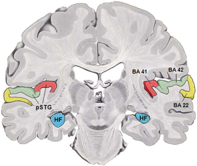 Human temporal lobe areas.png