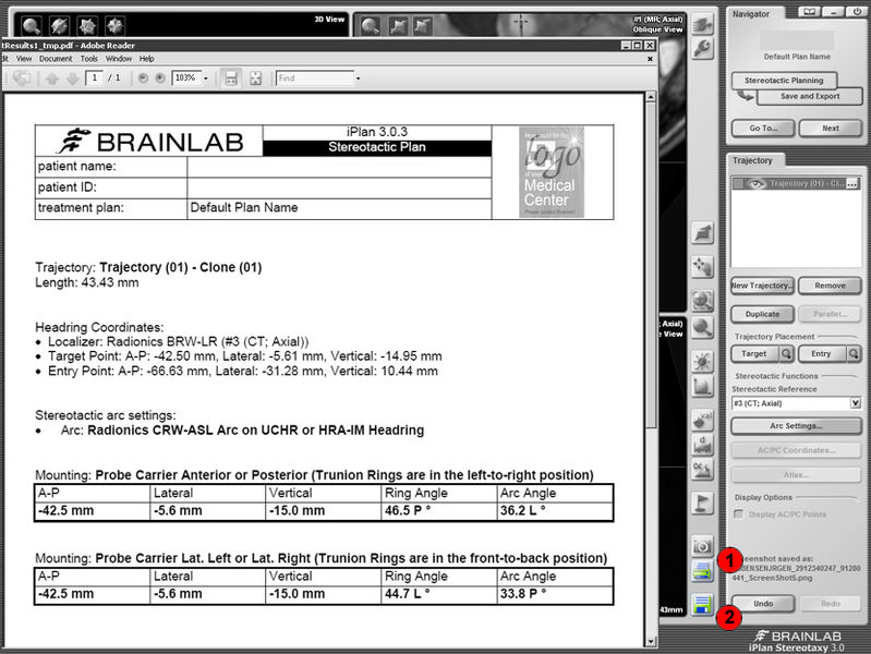 Fil:SB-BrainLab9x.jpg